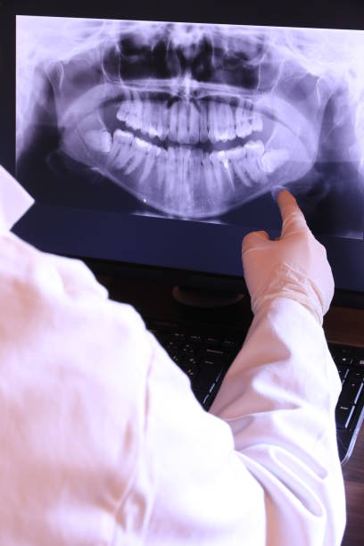 Best Broken or Chipped Tooth Repair in Lebanon South, PA